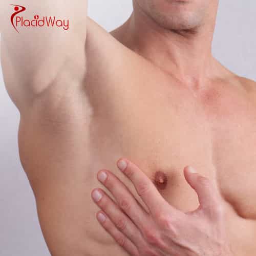 Gynecomastia Surgery for Men in Turkey: A UK Patient’s Cost and Procedure Guide